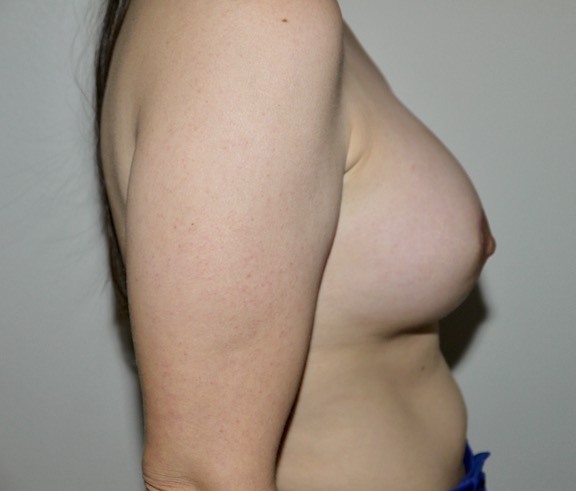 After Image