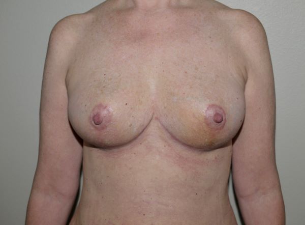 After Image