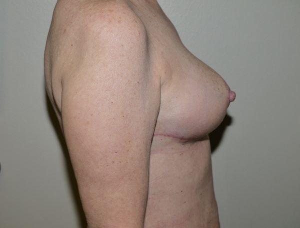 After Image