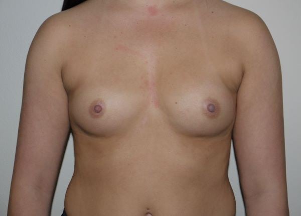 Before Image