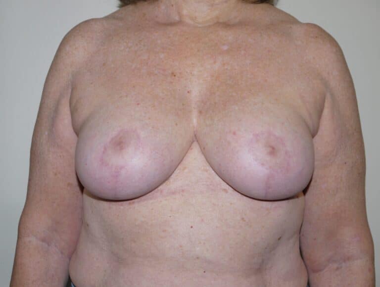 After Image