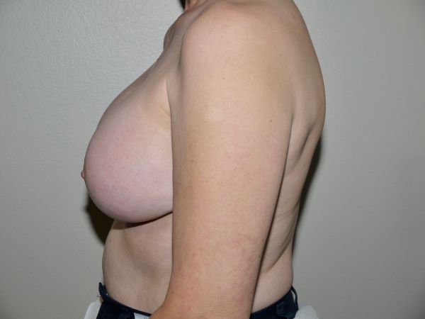After Image