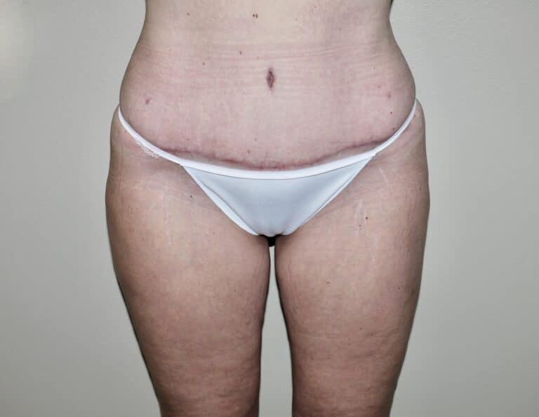 After Image