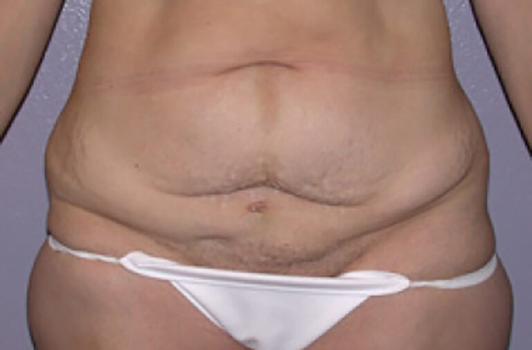 Before Image