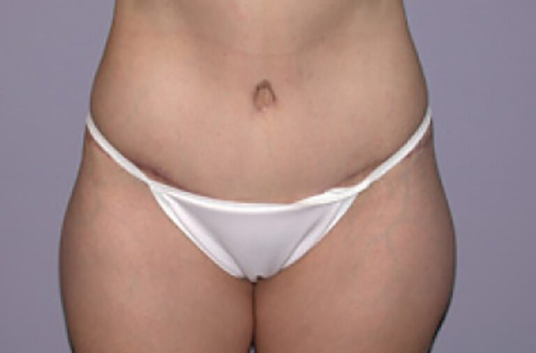 After Image