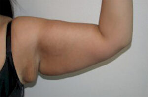 Patient Case #2936