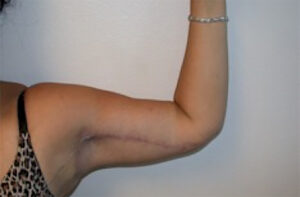 Patient Case #2936
