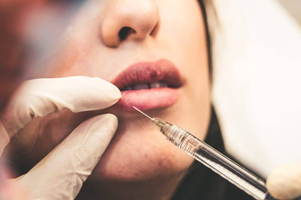 dermal fillers