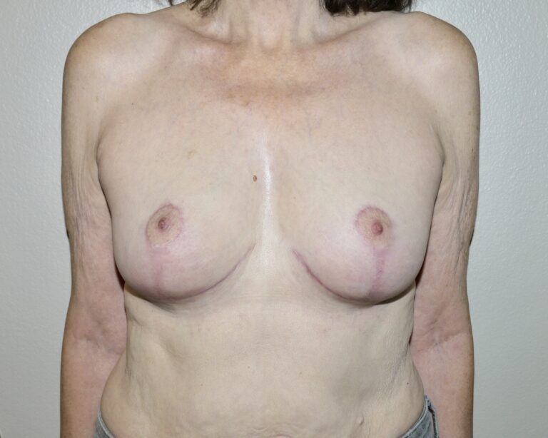 After Image