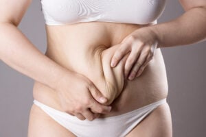 Woman tugging at loose skin around abdomen after losing weight