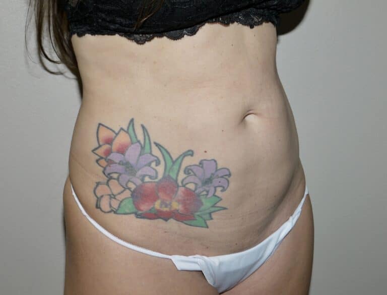 Before Image:  - right-front-oblique