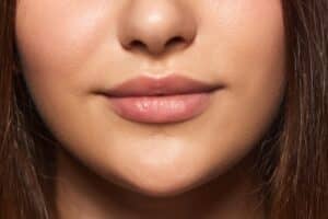 Young woman with natural-looking plump lips after lip augmentation using dermal fillers.